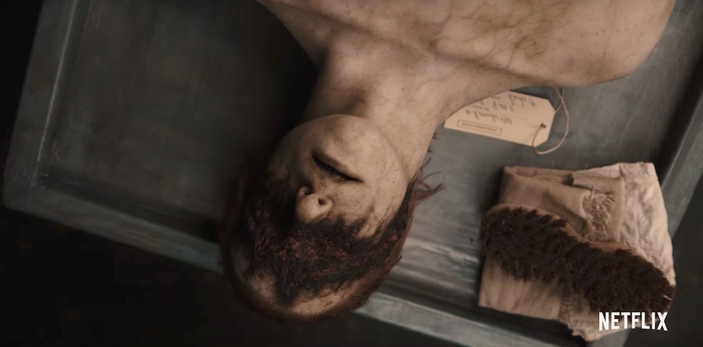 cadavre jeune homme, yeux et oreilles brûlées